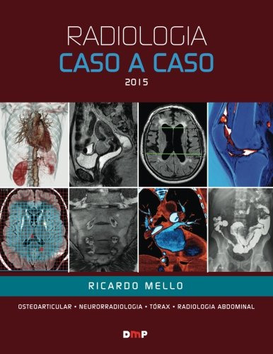 Radiologia Caso A Caso 2015