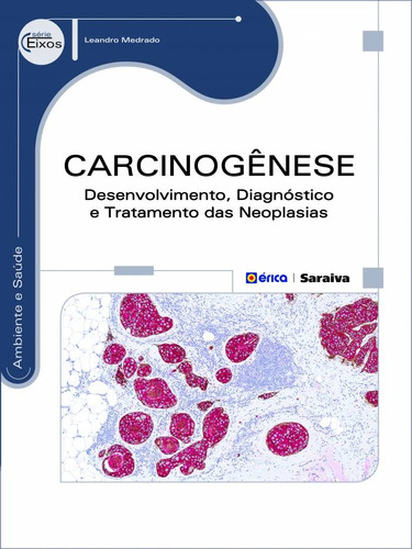 Carcinogênese: Desenvolvimento, diagnóstico e tratamento das neoplasias, de Medrado, Leandro. Editora Saraiva Educação S. A., capa mole em português, 2014