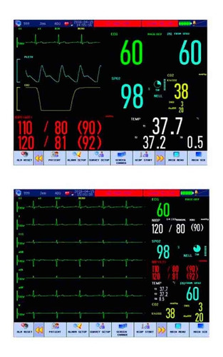 Imagen 3 de 7 de Equipo De Monitoreo Medico De Signos Vitales Spacelabs C50