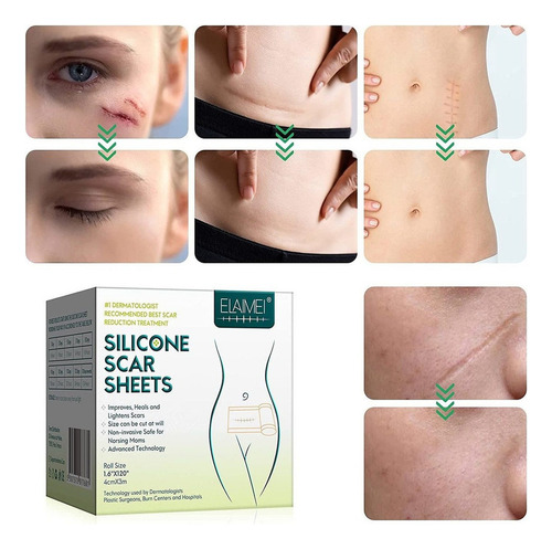 A Parche For Eliminar Cicatrices Con Cinta De Gel De