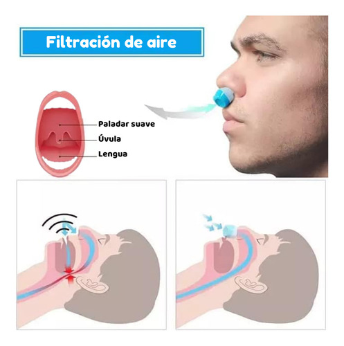 2pzs Dilatador Nasal Y Anillo Magnético Anti Ronquidos Apnea