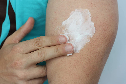 Kp Elements, Crema De Tratamiento Para La Queratosis Capilar