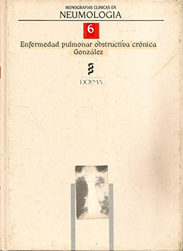 Libro Neumologia Monografias 6 De R. Rodriguez Roisin