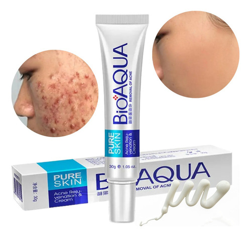 Bioaqua Acne Cream Cicatrices Poros Control De Grasa Full Tipo de piel Todo tipo de piel