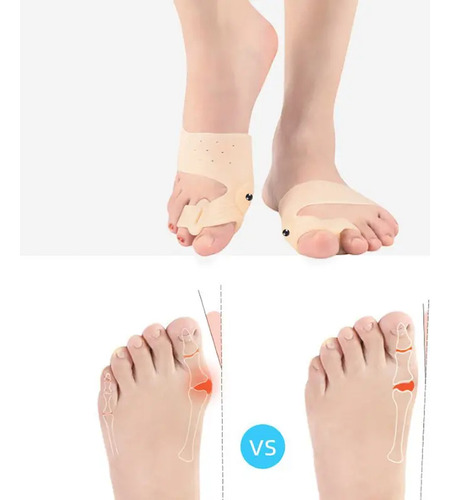 Separador Corrector Hallux Valgus Dedo Del Pie Silicon