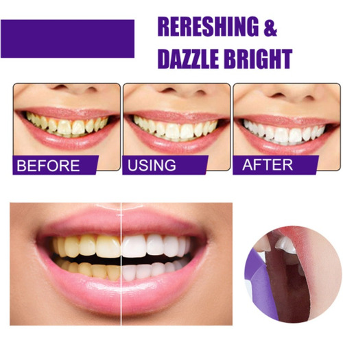 2 Piezas De Pasta De Dientes Morada Para Blanquear Los Dient