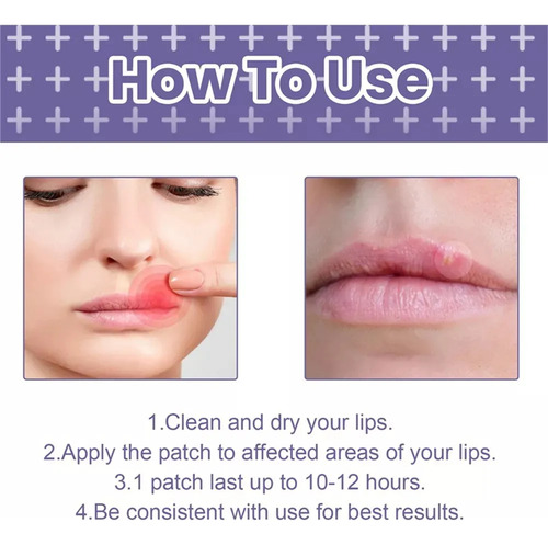 2 Parches Útiles Para Aliviar El Herpes Labial Y Curar La Di