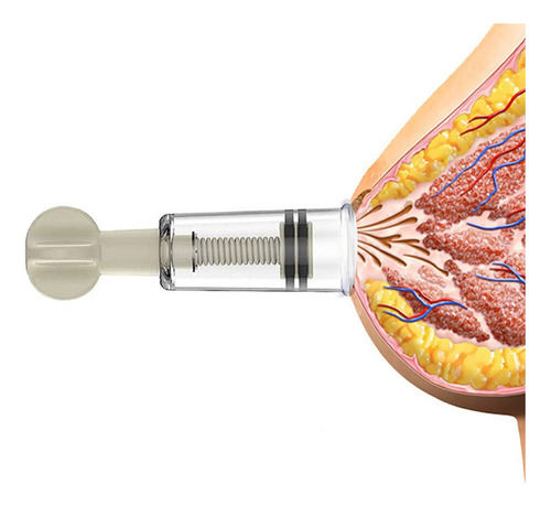 Corrector De Pezones De Silicona Nipplesuckers Para Pezones