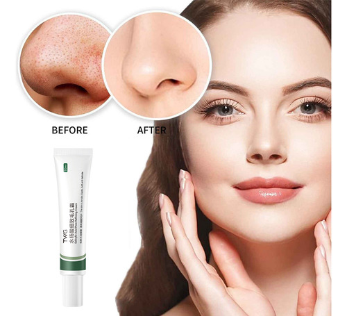Crema Reductora De Poros Con Ácido Salicílico X Salicylicaci