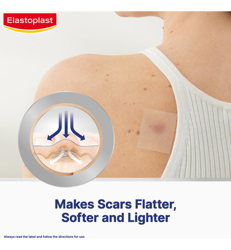 Emplastros Redutores De Cicatrizes, Elastoplasto, Tratamento