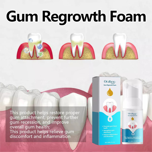 Espuma Para Crescimento Gengival Em Formato De V, 30 Ml