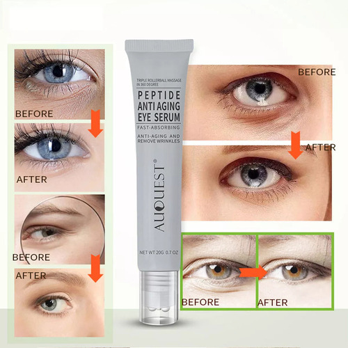 Crema Rejuvenecedora Para Ojos, Nutritiva, Hidratante, Aclar