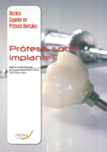 Libro Prótesis Sobre Implantes De Maria Isabel Aragoneses La