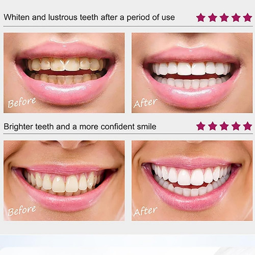 Polvo Blanqueador Dental, Creme Dental Mágico Whitening