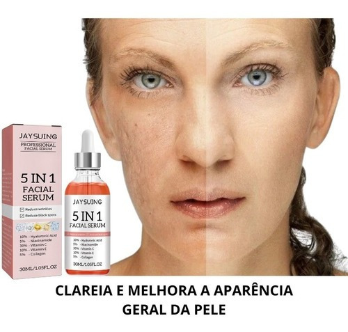 Sérum antiacné con 5% de niacinamida que reduce los poros dilatados 30 ml