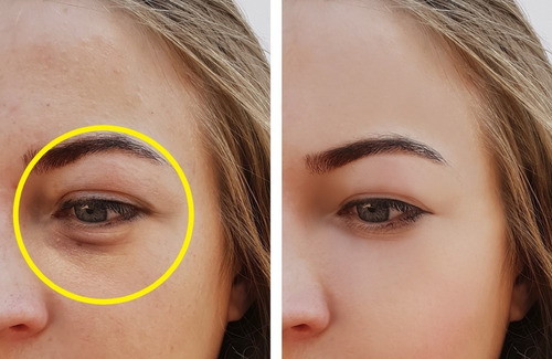 Serum Elimina Ojeras Arrugas Hialurónico Aclara Zona Oscura Tipo De Piel Todo Tipo De Piel