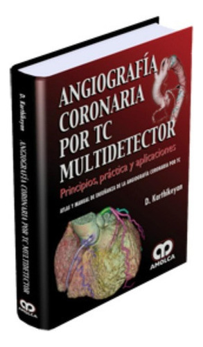 Angiografía Coronaria Por Tc Multidetector