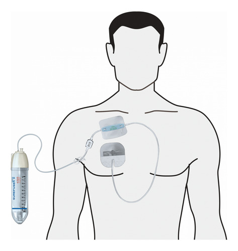 Sistema Infusión Continua Ambulatoria 250 Ml 5ml/hr Nipro