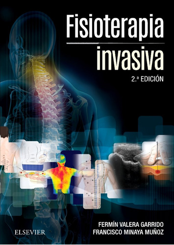 Fisioterapia Invasiva - Valera Fermin Minaya Francisco