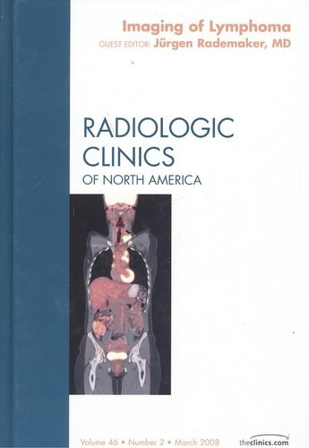 Libro 2.imaging Of Lymphoma Radiologic Clinics Of North Amer