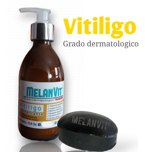 Crema Para Tratar Vitíligo