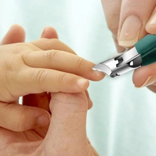 Cortauñas Para Uñas Encarnadas | Cortaúñas Con Ancha De