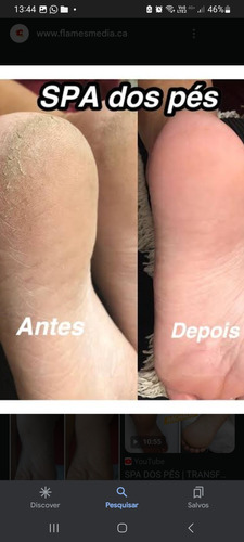 Beleza E Estetica Dos Pes