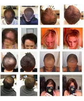 Comprar Cabello Instantaneo Anti Calvicie Hombre Mujer Salud Belleza