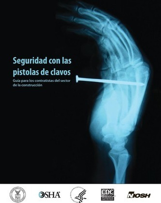 Seguridad Con Las Pistolas De Clavos - Department Of Heal...
