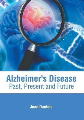 Libro Alzheimer's Disease: Past, Present And Future - Jua...