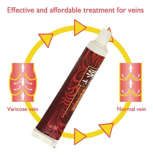 Crema Para Varices, 2 Unidades, 30 G, Tratamiento Para Espin