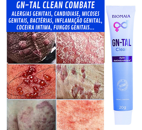 Kit 2 Pomada Íntima Masculina Antifúngica/alergia/virilha Fragrância Neutra