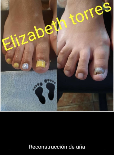Imagen 4 de 5 de Pedicuria