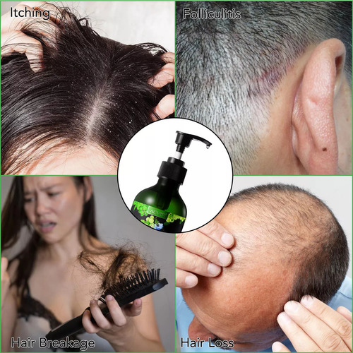Shampoo Nutre TĂș Cabello Hasta Raiz Y Puntas Aceite Ricino