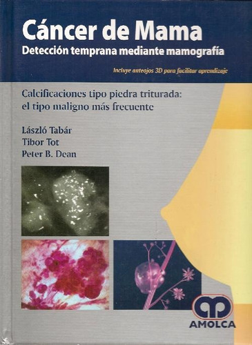 Libro Cancer De Mama Con Anteojos De 3 D De László Tabár Pet