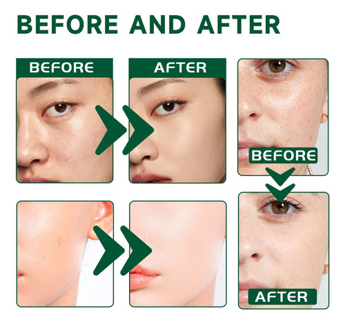 Hd Crema Facial Reparadora Roja G Centella Asiatica,