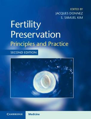 Libro Fertility Preservation : Principles And Practice - ...