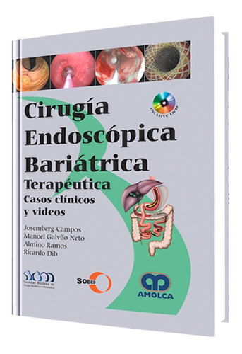 Cirugía Endoscópica Bariátrica Terapéutica. Casos Clínicos.