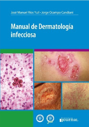 Manual De Dermatología Infecciosa
