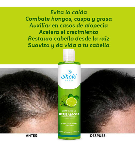 Imagen 5 de 8 de Shampoo Bergamota Crecimiento Cabello Alopecia Anticaída