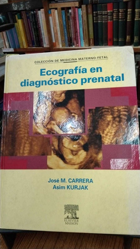 Ecografía De Diagnóstica Prenatal - Carrera