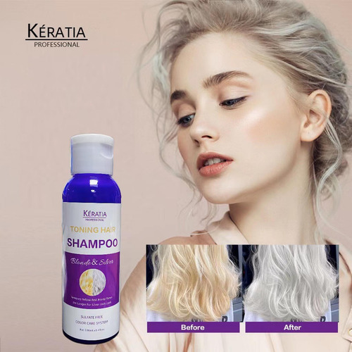 Ayuda A Tratar La Dermatitis Seborreica (dermatitis Atópica)