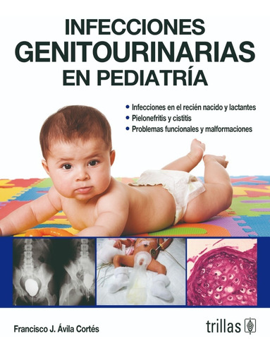 Infecciones Genitourinarias En Pediatría Editorial Trillas