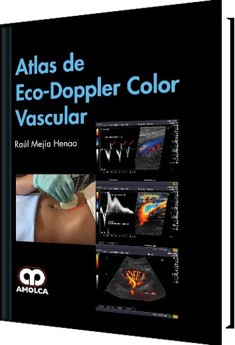 Atlas De Eco Doppler Color Vascular Mejia