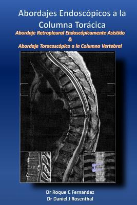 Libro Abordajes Endoscopicos A La Columna Toracica : Abor...