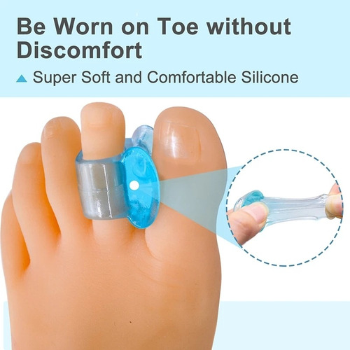 Corrector De Juanetes Hallux Valgus Separador (par) Azul