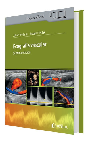 Ecografia Vascular Septima Edicion