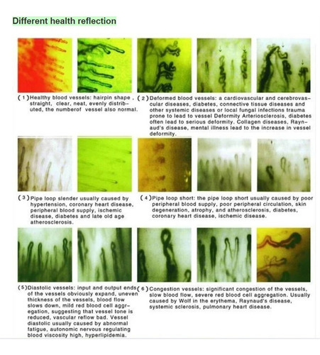 Microscopio De Análisis De La Microcirculación Capilar