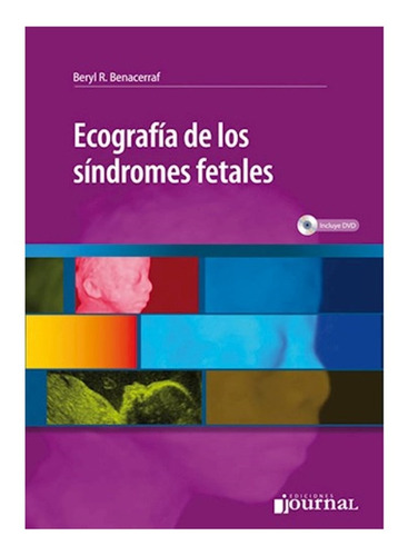 Ecografía De Los Síndromes Fetales - Benacerraf, Beryl R. 