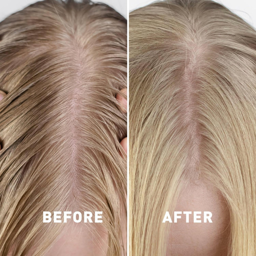 Shampoo Just Nutritivo Para Cabelos Oleosos | Controlar ResĂ